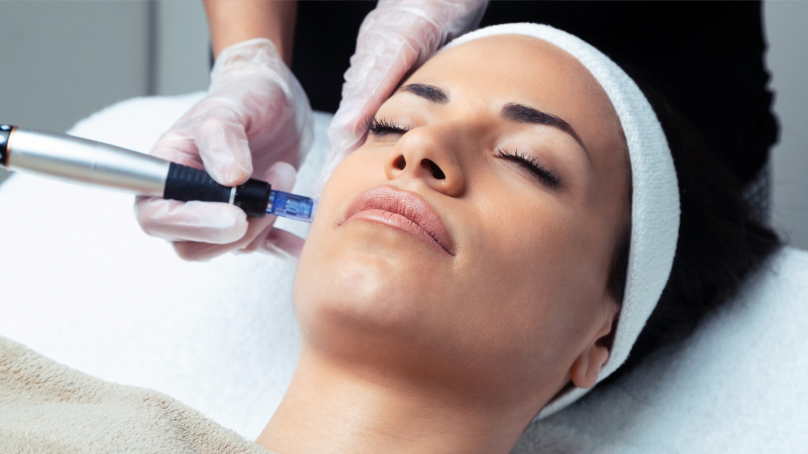 Next-gen microneedling treatment being performed at The Laser Lounge & Skin