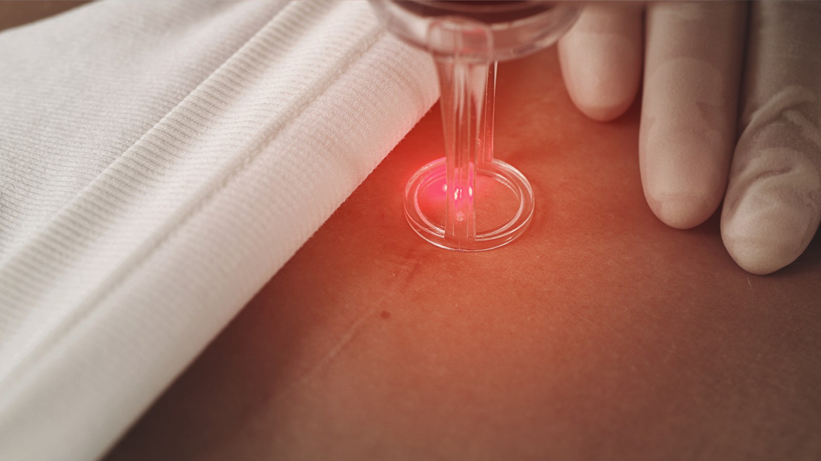 Scar removal treatment being performed at The Laser Lounge & Skin